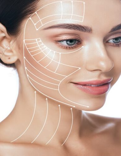 High Smas Tekniği ile Yüz Germe