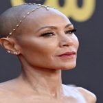 Saçkıran ve Saç Dökülmesi