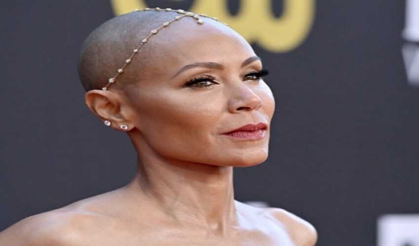 Saçkıran ve Saç Dökülmesi