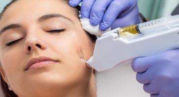 Köklerden Gelen Güzellik