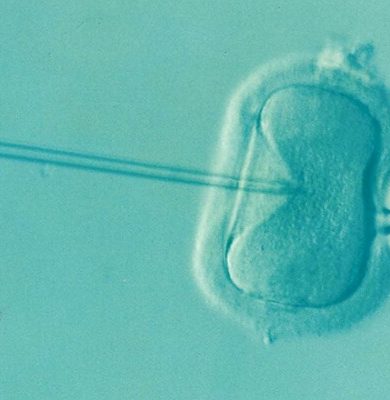 Tüp bebek tedavisi nedir?