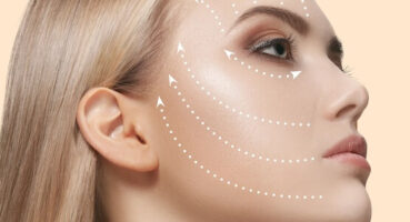 Sıvı Yüz Germe Nedir?