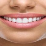 Gülüş Estetiği: Mükemmel Gülüşe Ulaşmanın Yolları