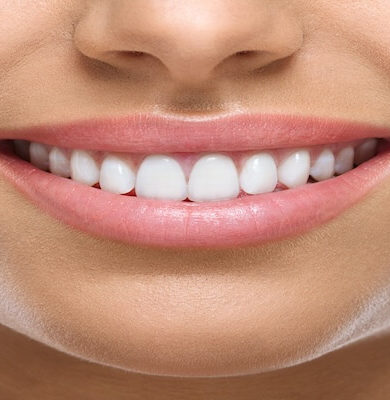 Gülüş Estetiği: Mükemmel Gülüşe Ulaşmanın Yolları