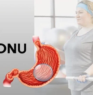 Yutulabilir Mide Balonu