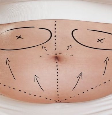 Karın Germe Ameliyatının Önemi ve Op. Dr. Gökhan Semerci’nin Uzmanlığı