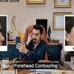 Yüz Estetiğinde Bütüncül Yaklaşım: Kapsamlı Yüz Feminizasyon Cerrahisi