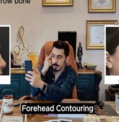 Yüz Estetiğinde Bütüncül Yaklaşım: Kapsamlı Yüz Feminizasyon Cerrahisi