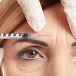 Botoks ile Genç ve Dinamik Bir Görünüm: Op. Dr. Gökhan Semerci’den Uzman Dokunuşlar